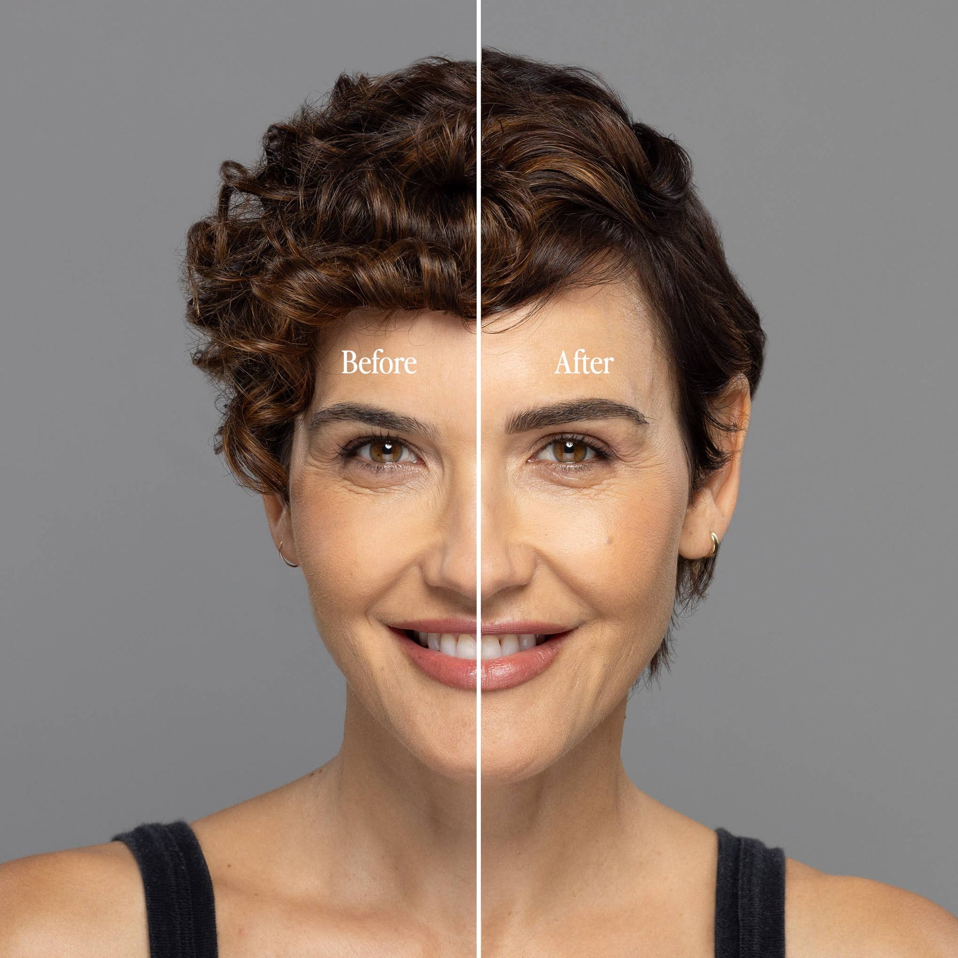 Billion Dollar Brow Lift®