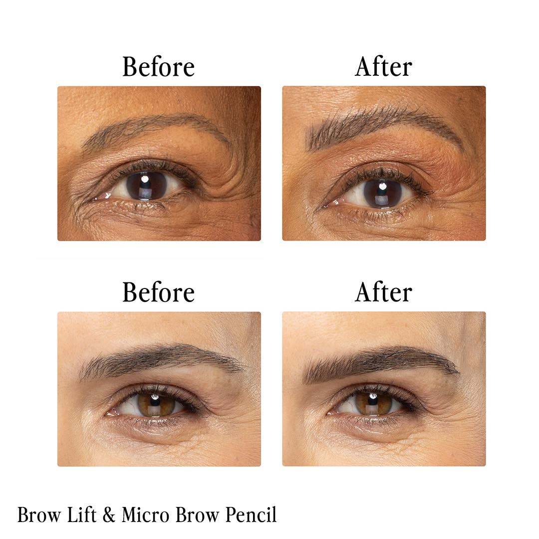 Billion Dollar Brow Lift®