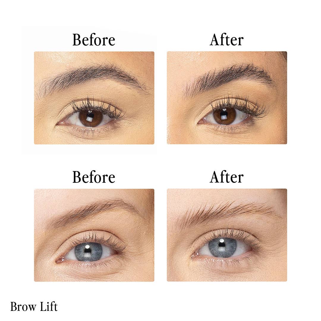 Billion Dollar Brow Lift®